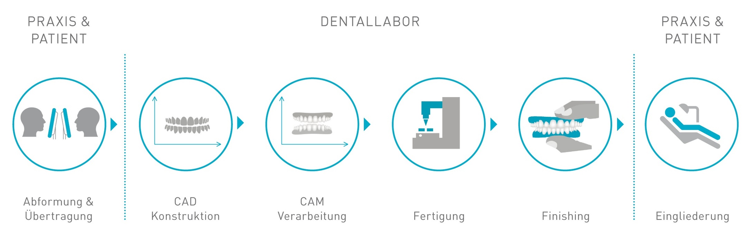 Schematischer Ablauf zur Herstellung einer Prothese